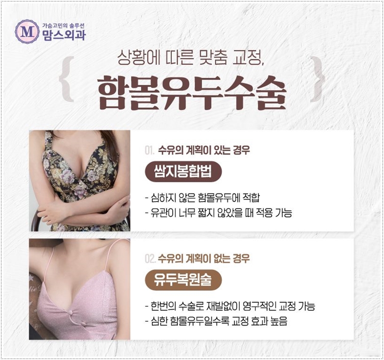 함몰유두수술 적합한 기법으로 관련 이미지 8