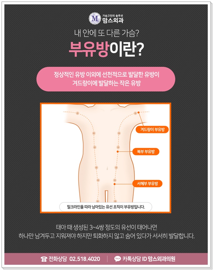 부유방수술 제대로 알고 결정하자! 관련 이미지 2