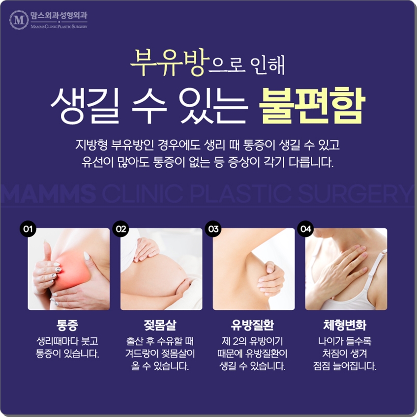부유방제거수술 내게 맞는 것으로 관련 이미지 3