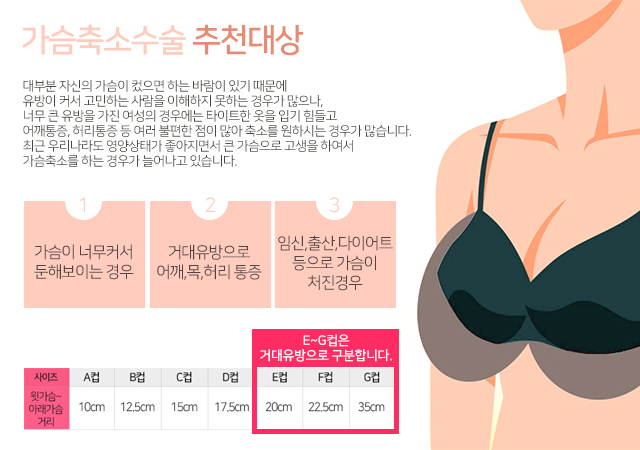 가슴축소술 자신있는나로! 관련 이미지 2