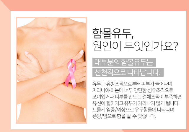 함몰유두분비물 방치마세요 관련 이미지 2