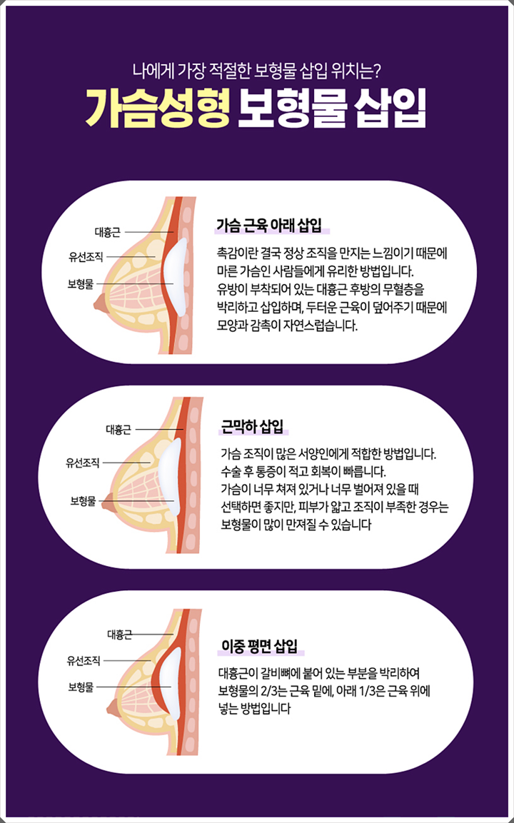 벨라젤마이크로 내 체형에 맞는 변화 관련 이미지 7