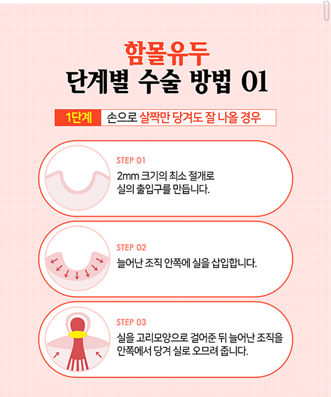 함몰유두수술후기 어떻게 변할까 관련 이미지 7
