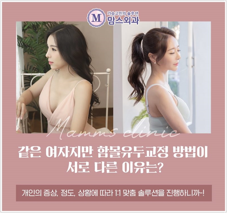 함몰유두수술 적합한 기법으로 관련 이미지 6