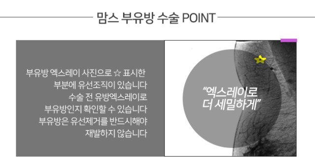 부유방원인 정확하게알아봐요 관련 이미지 5