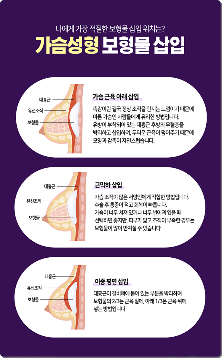 벨라젤마이크로 자연스럽게 부드러워! 관련 이미지 8