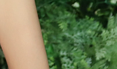 부유방통증 원인을 제대로 파악한 맞춤형 수술로 개선하세요! 관련 이미지 21