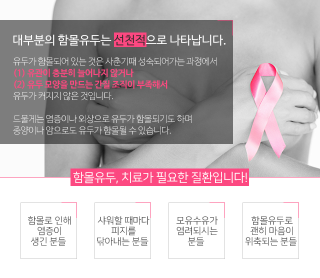 임산부함몰유두 늦기전에 관련 이미지 2