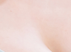 Breast Lift for Sagging Breasts: Lift Your Bust, Lift Your Confidence! image 17