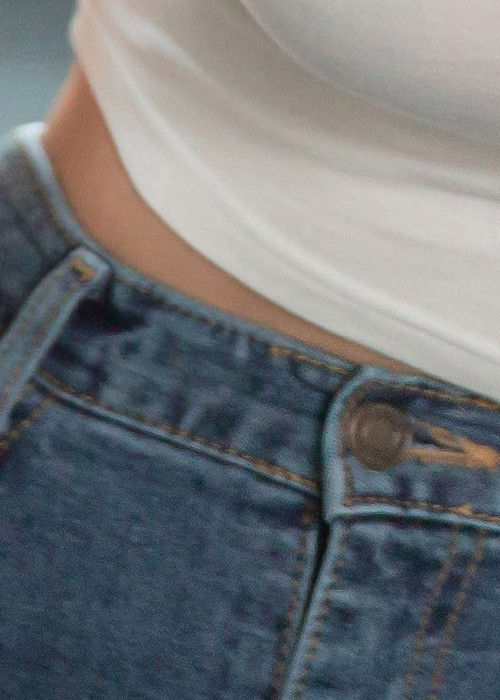 겨드랑이유선 깨끗하게 관련 이미지 23