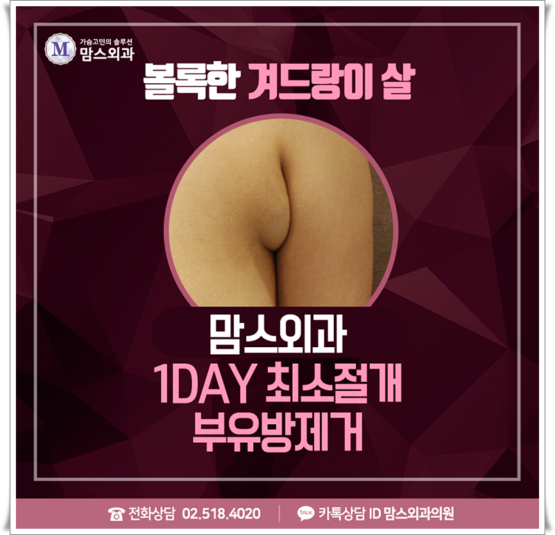부유방살빼기 가능할까요? 관련 이미지 1