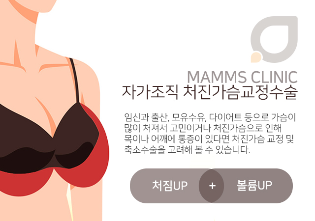 처진가슴교정 안전까지생각 관련 이미지 2