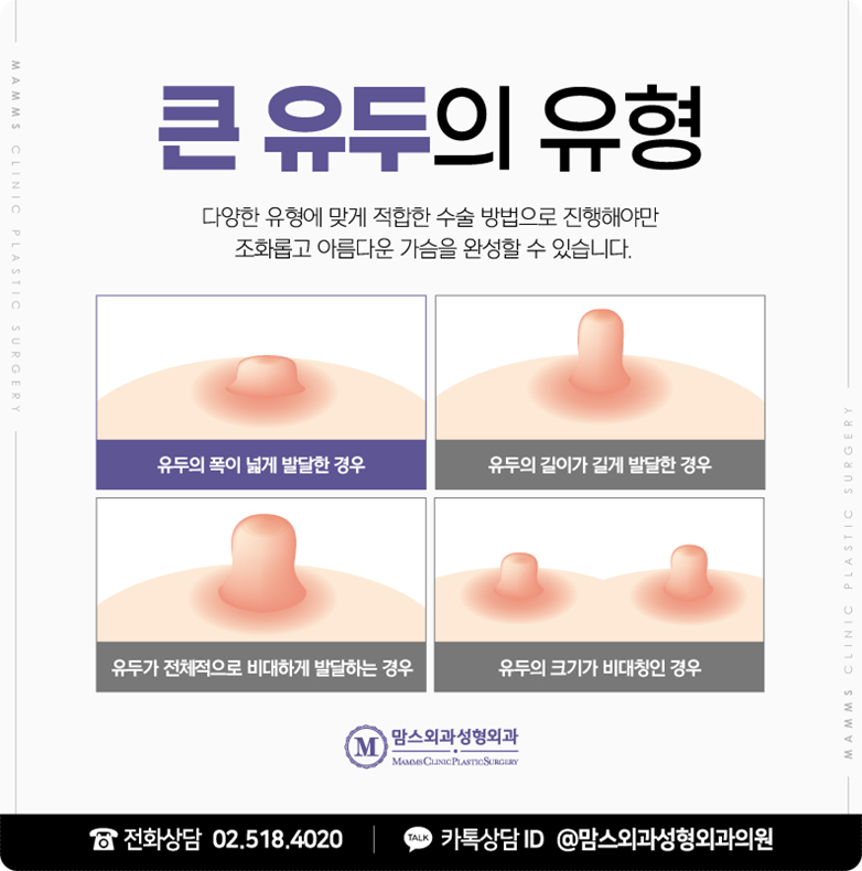 유두축소수술후기 보신 적 있나요? 관련 이미지 6