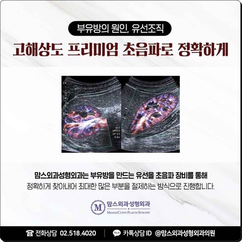 부유방병원 군더더기 없이 관련 이미지 7