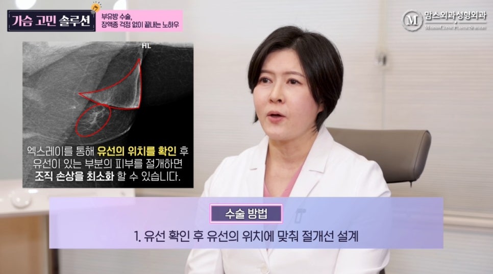 부유방 제거 수술, 장액종 없이 가능할까요? 관련 이미지 6