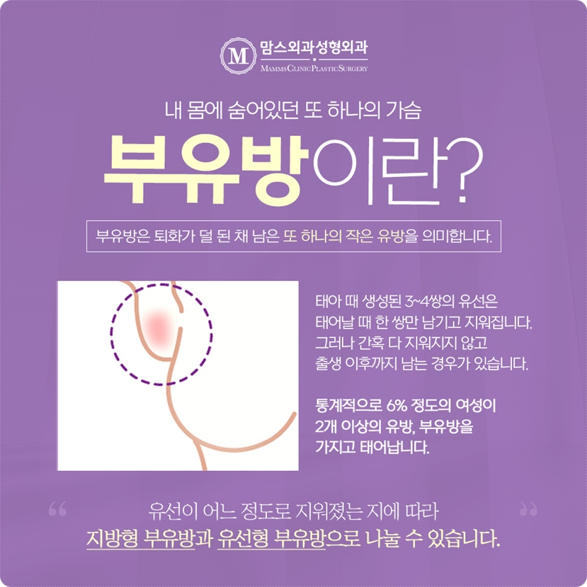 Axillary accessory breast tissue removal — does it differ case by case? image 3