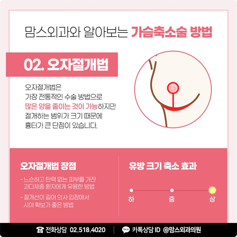가슴축소수술방법 좀더 깔끔하게 관련 이미지 5