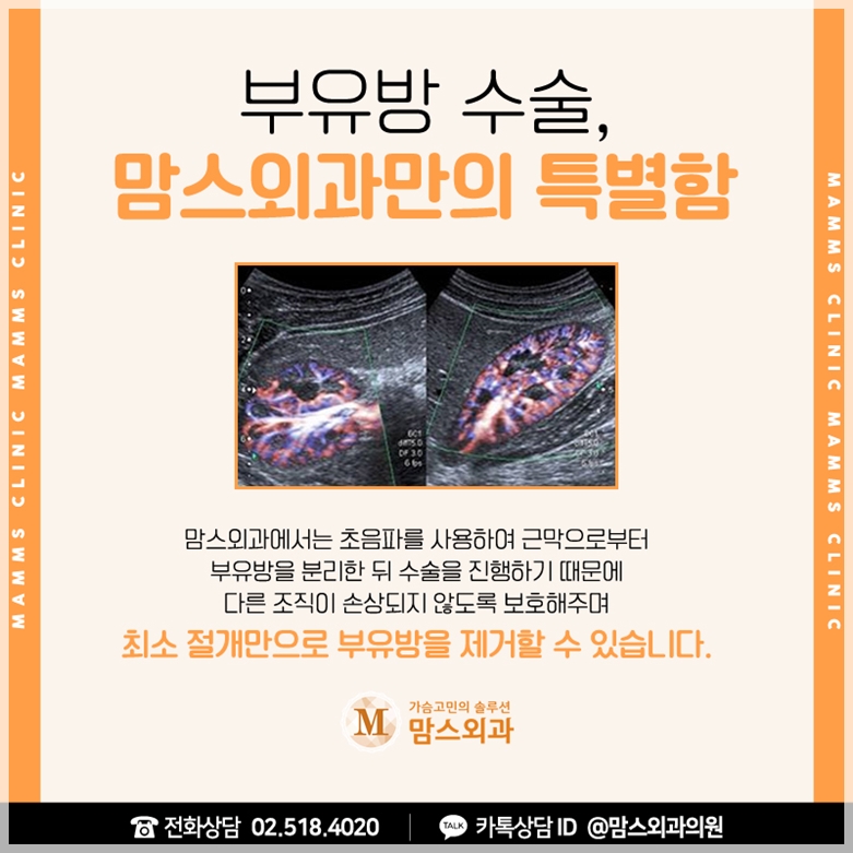 부유방빼기 꼼꼼하게 체크해요. 관련 이미지 9