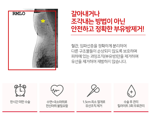 겨드랑이 밑 통증 큰일은아닐까 관련 이미지 4