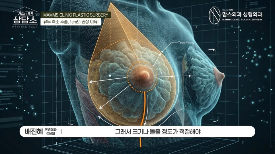 유두 크기에도 황금비율이 있다? 유두 축소 수술, 1cm가 중요한 이유 관련 이미지 2