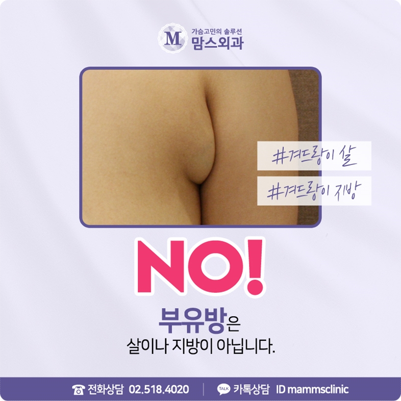 겨드랑이살빼기 쉽게 안 빠진다면 관련 이미지 6