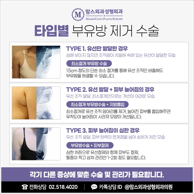 When Examining Axillary Accessory Breast Removal Carefully image 8