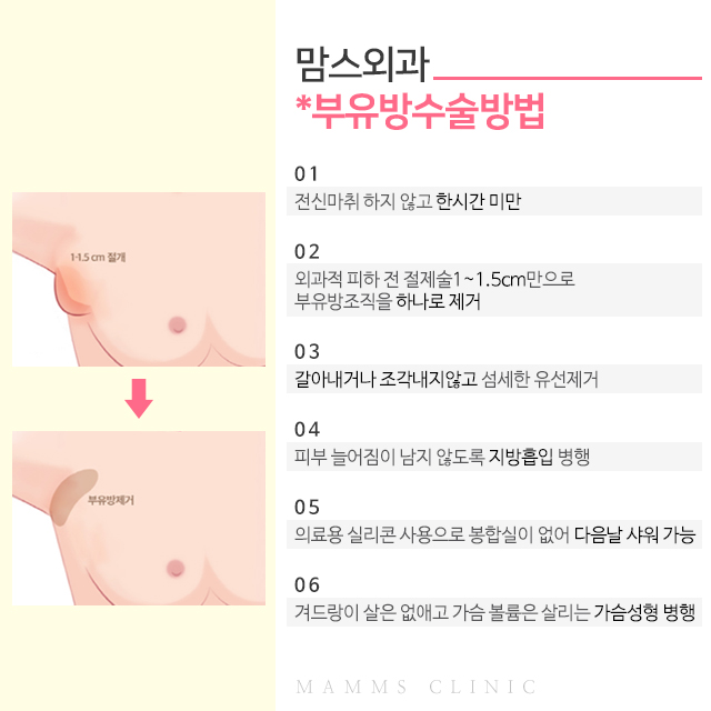 임산부부유방 속앓이는그만 관련 이미지 3