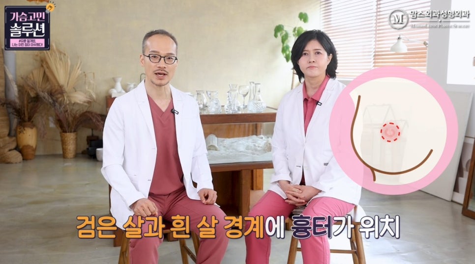 Breast Reduction with Areolar Incision: What Was the Drawback? image 9