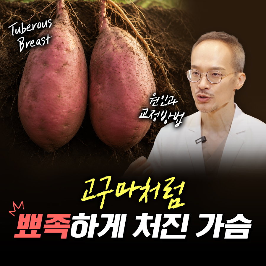 고구마처럼 뾰족하게 처진 가슴 원인과 교정방법! 관련 이미지 1