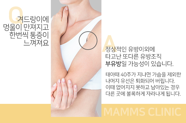 겨드랑이아래통증 왜이런걸까 관련 이미지 2