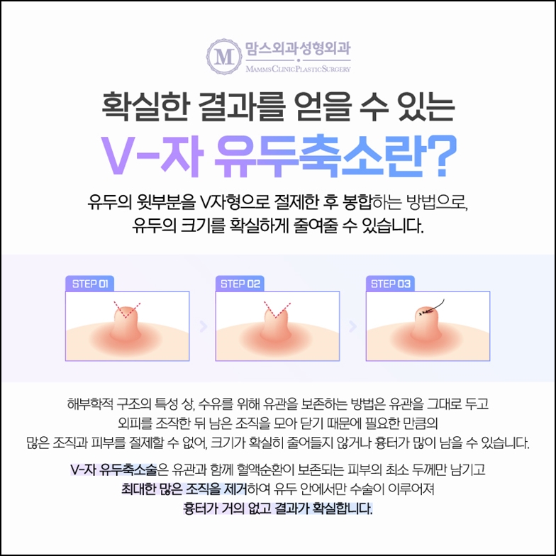 유두축소수술비용 절약하고 싶다고? 관련 이미지 8