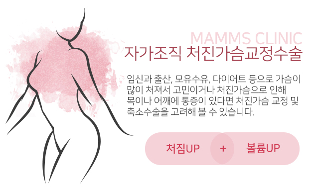 처진가슴수술후기 비교해보세요 관련 이미지 2