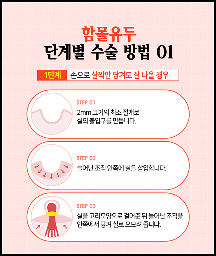 함몰유두수술비용 올바른 선택을 위해서는? 관련 이미지 5