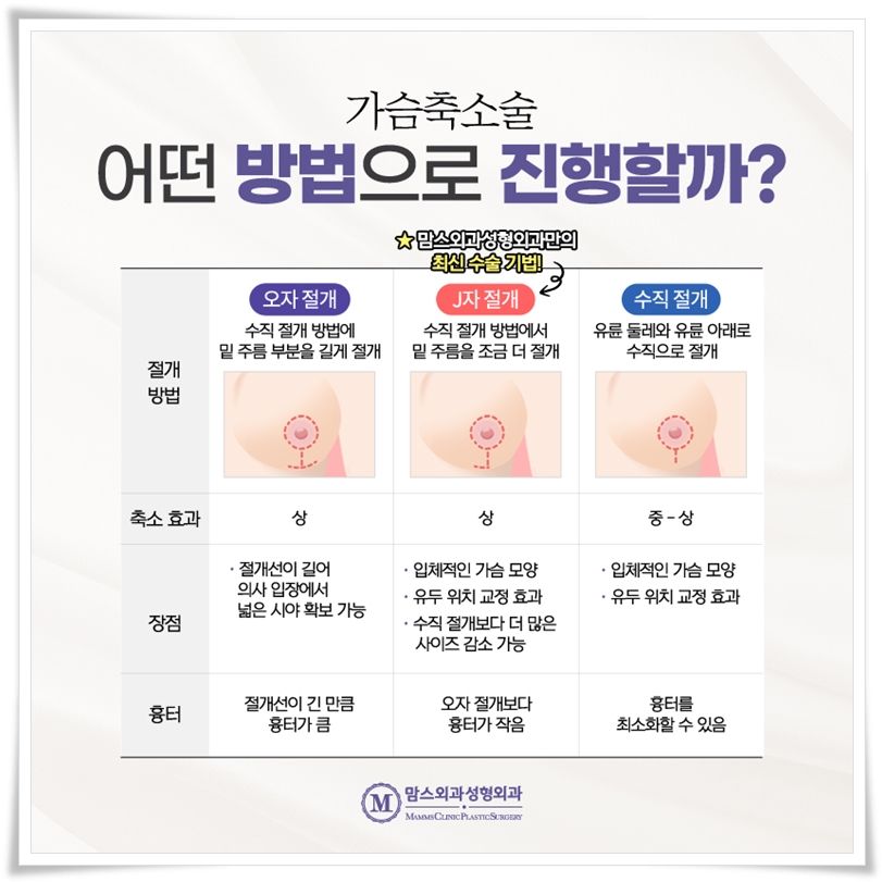가슴축소수술 가격, 무엇을 봐야할까? 관련 이미지 4
