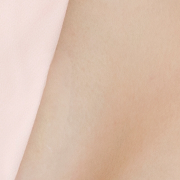 Could the protruding underarm bulge be an accessory breast instead of fat? image 24