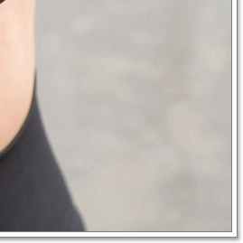 Breast Sagging Surgery to Regain Firmness image 23