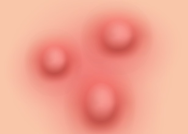 Geoyeo-dong Dermatology: Click Only If You Don’t Want to Waste Money on Juvelook image 8