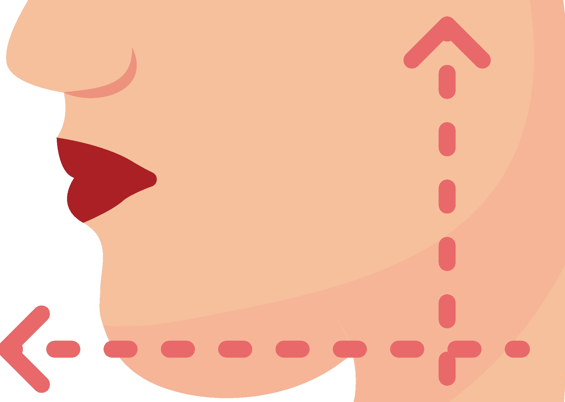 Jamsil Square Jaw Botox: Worried About Resistance? Be Sure to Read This image 5
