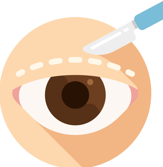 Songpa Plastic Surgery for Eye Surgery? Upper Eyelid or Lower Eyelid Surgery? Age Does Not Matter image 7