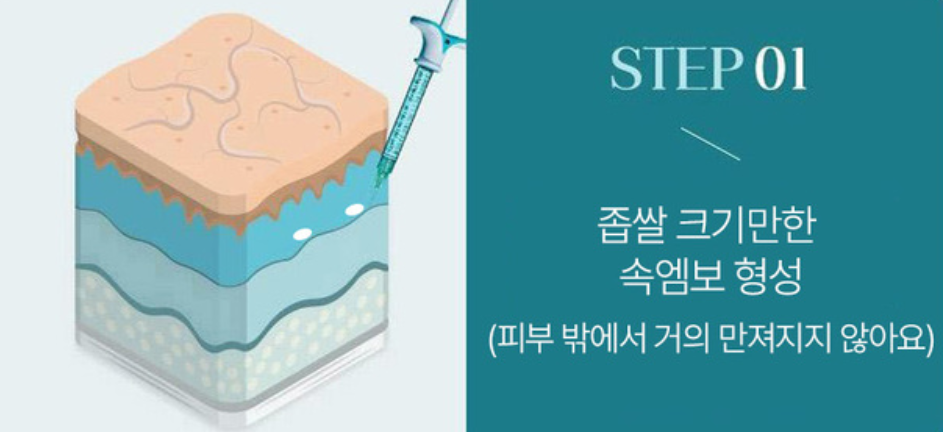 Jamsil Station Forehead and Glabella Botox? Here’s How a Good Clinic Does It image 3