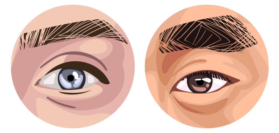 Does double eyelid surgery work in your 40s and 50s? A complete guide to recovery and side effects image 4