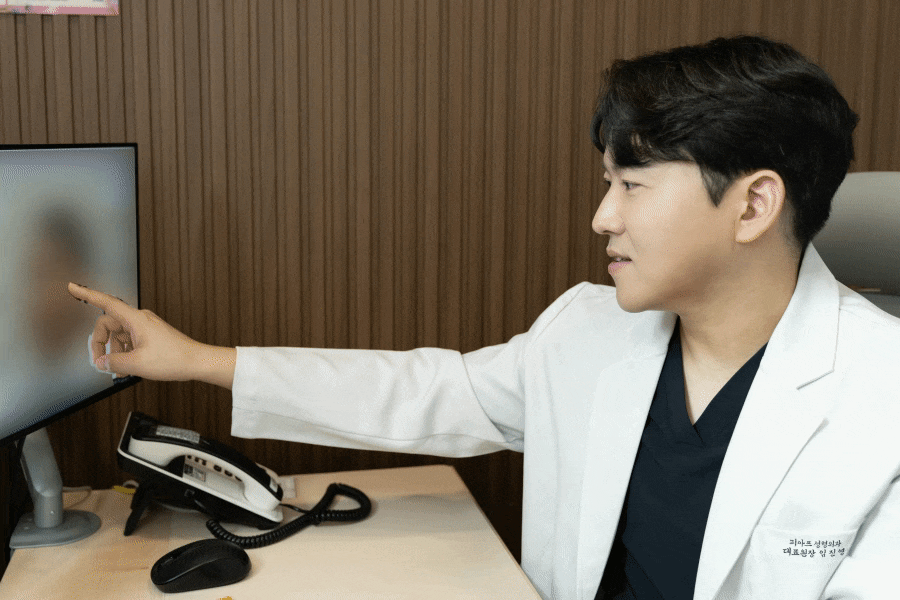 잠실눈성형, 자연스러운 결과를 위한 관련 이미지 7
