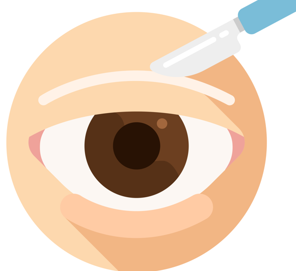 Upper Eyelid Surgery Price? Side Effects? Click If You’re Worried image 7
