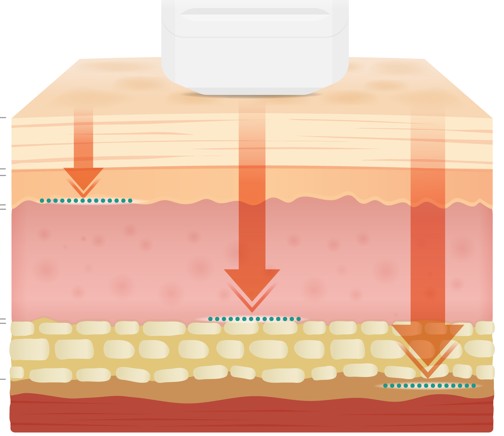 3 Things to Know Before Getting Garak-dong Skin Care <Written by a Doctor> image 5