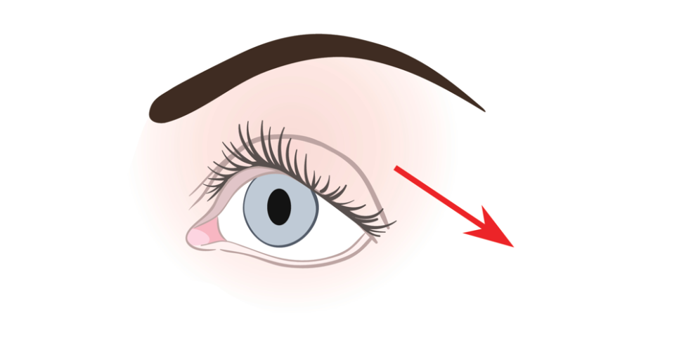 Eyebrow Lift Surgery Review? Here’s One Important Thing to Know image 3