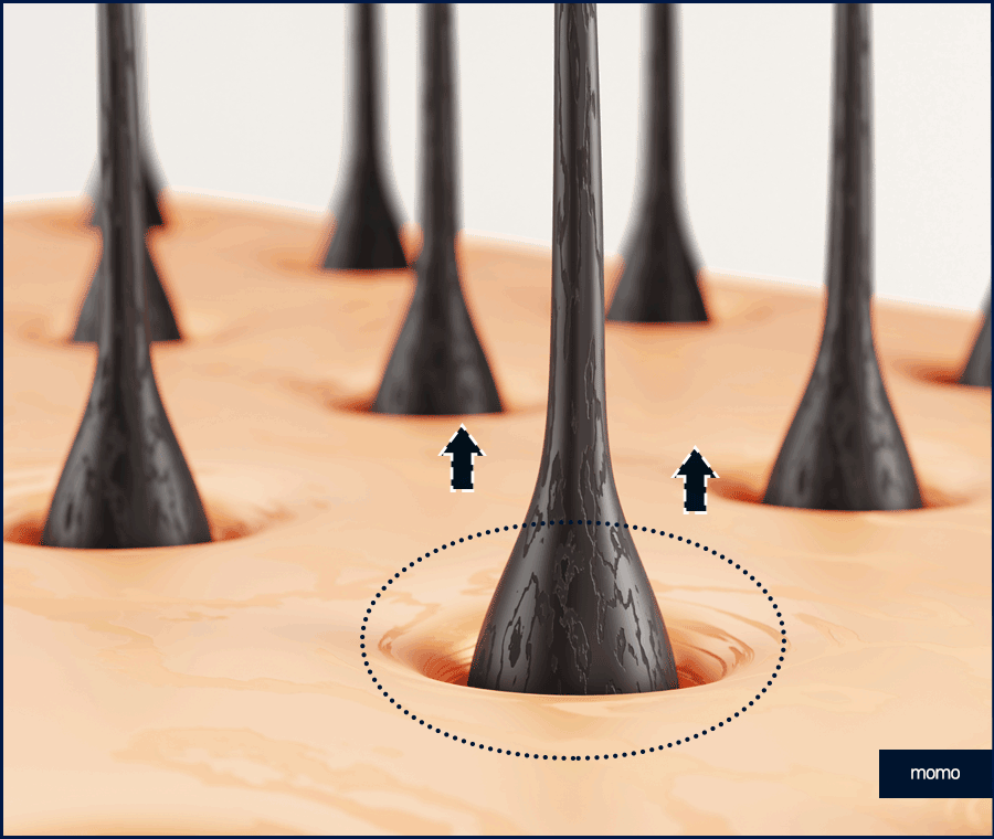 서울 탈모 성지 풍성함을 만들기 위한 방법 2가지 관련 이미지 2