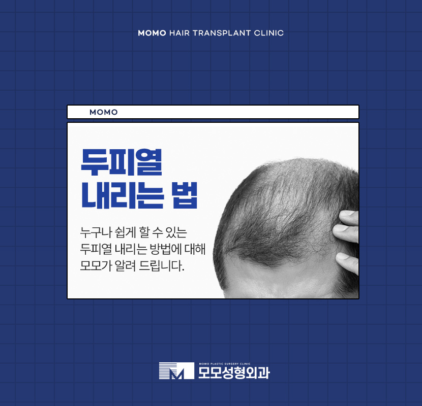 두피열 내리는 법 누구나 쉽게 할 수 있는 관련 이미지 1