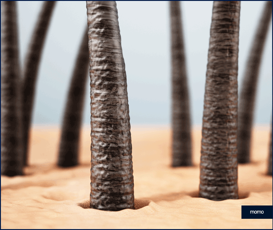 m자탈모병원 모발이식 고민이신 분들이라면 필독 관련 이미지 13