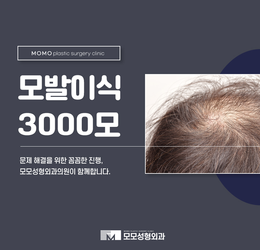 모발이식3000모 꼼꼼하게 심기 위한 관련 이미지 1