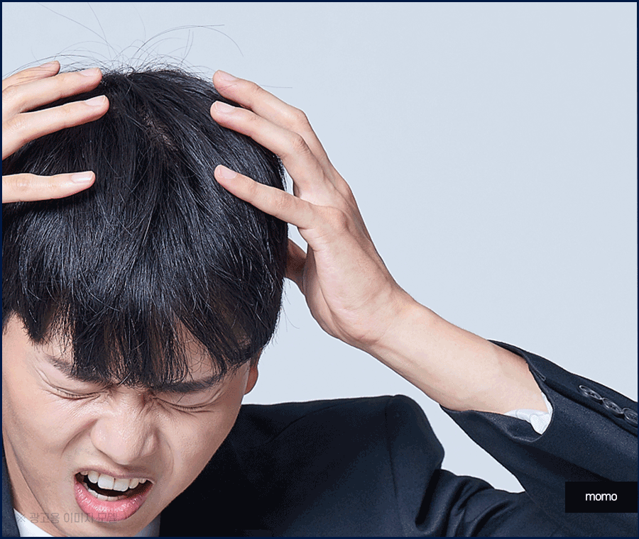 20대 모발이식 성공적인 결과를 위한 필수 조건 관련 이미지 4